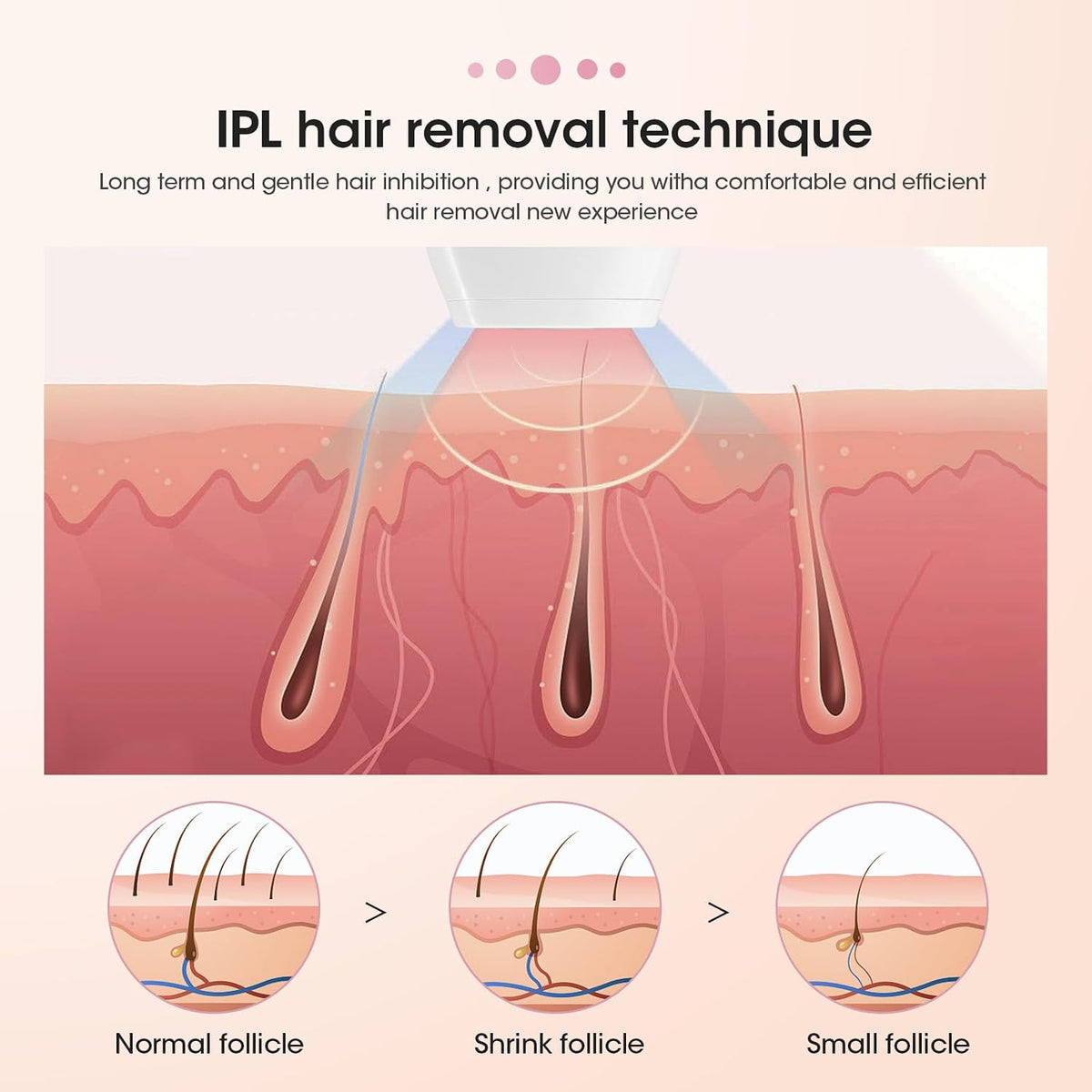 TOPEV IPL Mini Depilator për Heqjen e Qimeve – 500,000 Impulse, 5 Nivele Energjie, 2 Modalitete, për Fytyrë, Trup dhe Zonë Bikini, i Bardhë